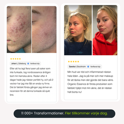 Organic Essence™ — Naturlig djuprengöring mot akne och porer