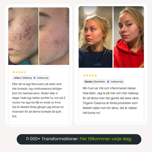 Organic Essence™ — Naturlig djuprengöring mot akne och porer